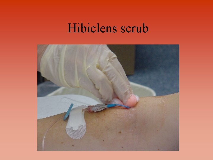 Hibiclens scrub 