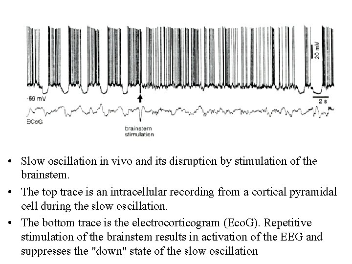  • Slow oscillation in vivo and its disruption by stimulation of the brainstem.