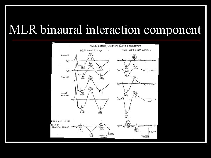 MLR binaural interaction component 