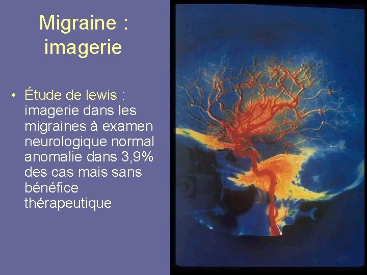 Migraine : imagerie • Étude de lewis : imagerie dans les migraines à examen