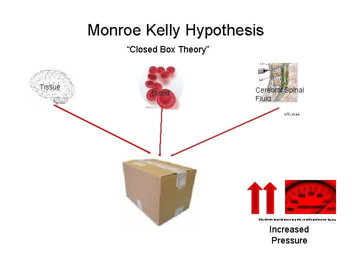 Monroe Kelly Hypothesis “Closed Box Theory” Tissue Blood Cerebral Spinal Fluid http: //www. hypertension-experts.