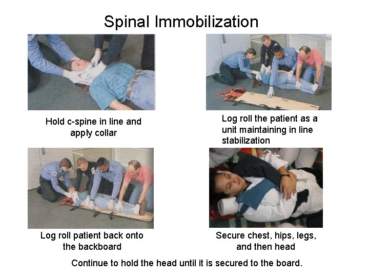 Spinal Immobilization Hold c-spine in line and apply collar Log roll the patient as