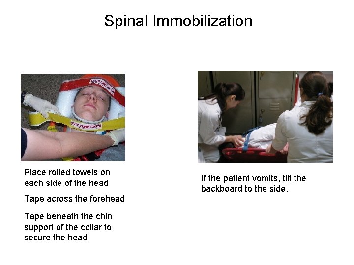 Spinal Immobilization Place rolled towels on each side of the head Tape across the