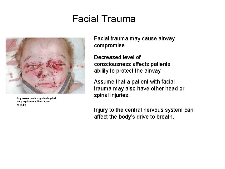 Facial Trauma Facial trauma may cause airway compromise. Decreased level of consciousness affects patients