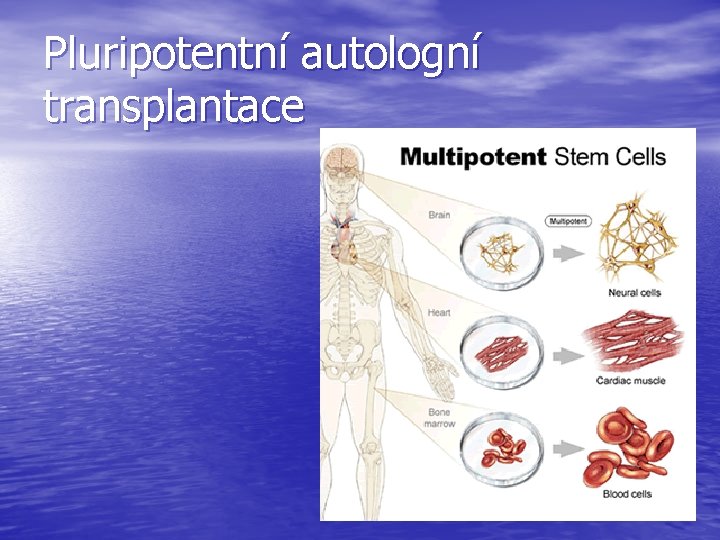 Pluripotentní autologní transplantace 