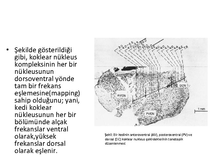  • Şekilde gösterildiği gibi, koklear nükleus kompleksinin her bir nükleusunun dorsoventral yönde tam