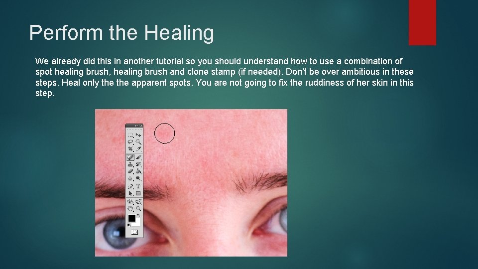 Perform the Healing We already did this in another tutorial so you should understand Perform the Healing We already did this in another tutorial so you should understand