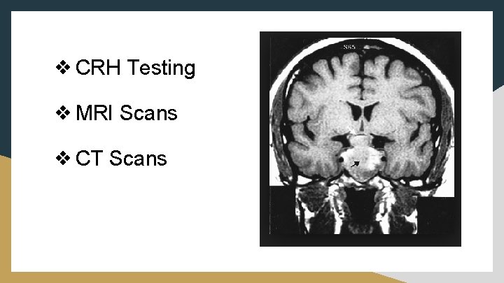 ❖ CRH Testing ❖ MRI Scans ❖ CT Scans 