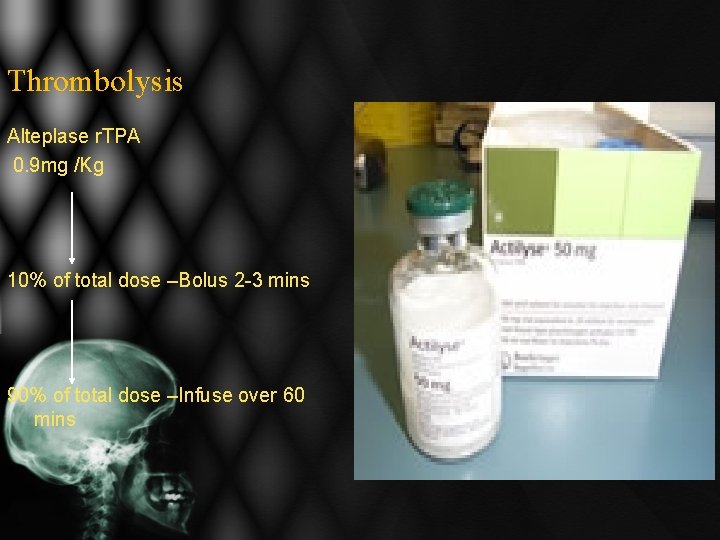 Thrombolysis Alteplase r. TPA 0. 9 mg /Kg 10% of total dose –Bolus 2 Thrombolysis Alteplase r. TPA 0. 9 mg /Kg 10% of total dose –Bolus 2
