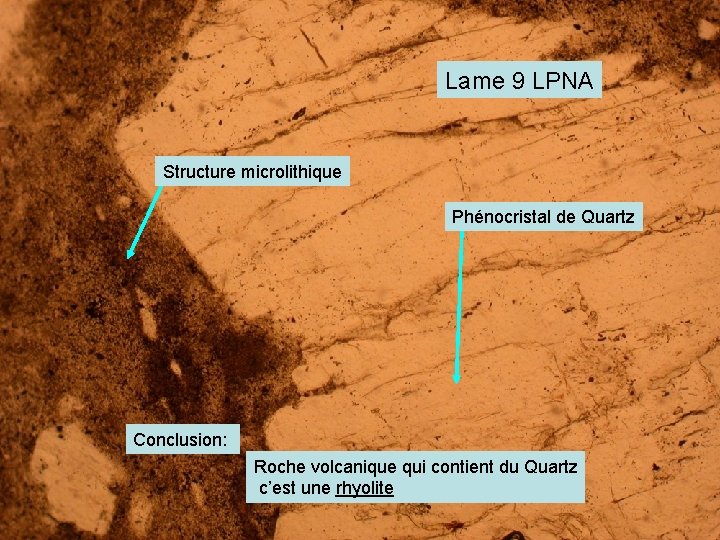 Lame 9 LPNA Structure microlithique Phénocristal de Quartz Conclusion: Roche volcanique qui contient du