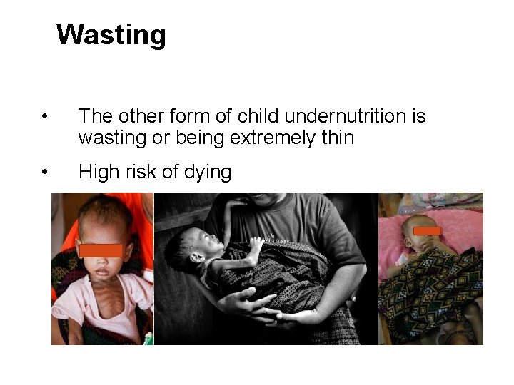 Wasting • The other form of child undernutrition is wasting or being extremely thin