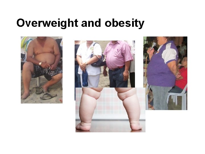Overweight and obesity 