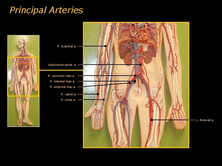 Principal Arteries R. brachial a. Abdominal aorta a. R. common iliac a. R. internal