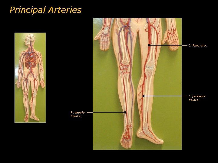 Principal Arteries L. femoral a. L. posterior tibial a. R. anterior tibial a. 