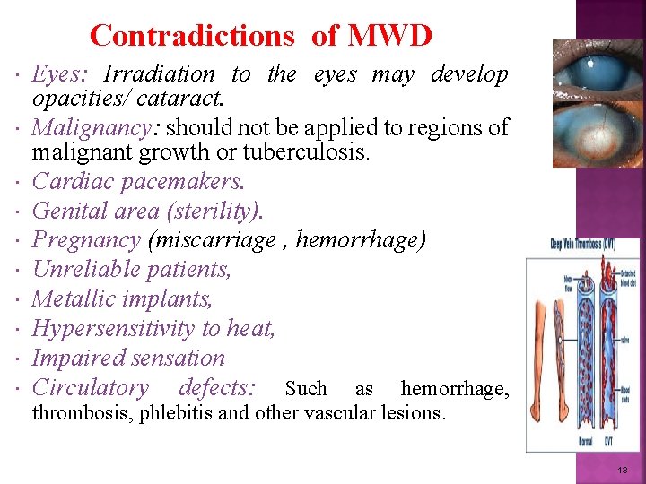Contradictions of MWD Eyes: Irradiation to the eyes may develop opacities/ cataract. Malignancy: should