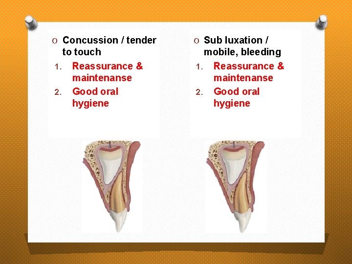 O Concussion / tender to touch 1. Reassurance & maintenanse 2. Good oral hygiene