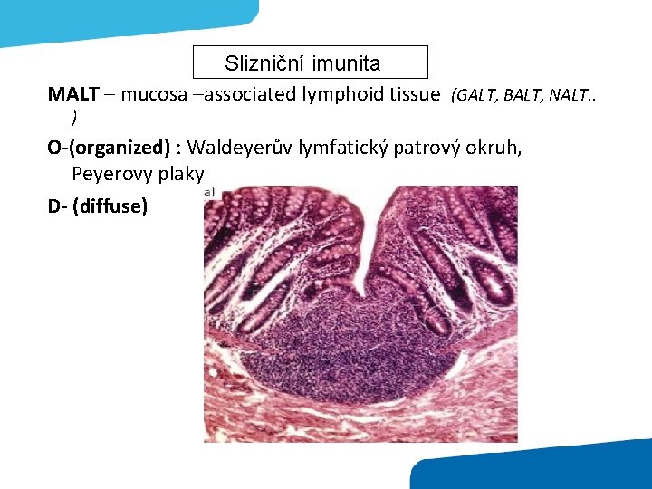 Slizniční imunita MALT – mucosa –associated lymphoid tissue (GALT, BALT, NALT. . ) O-(organized)