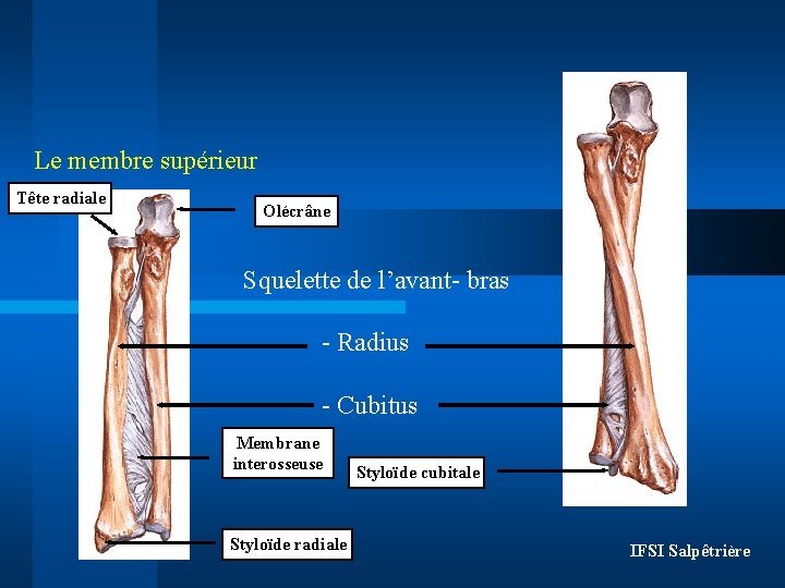 Le membre supérieur Tête radiale Olécrâne Squelette de l’avant- bras - Radius - Cubitus