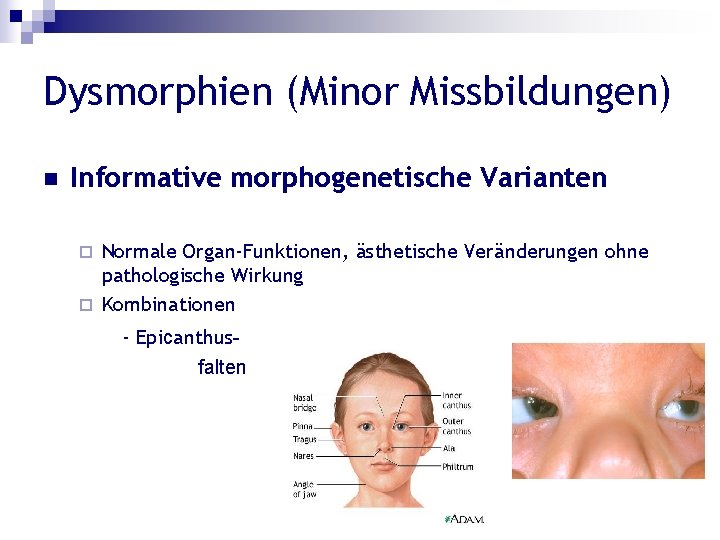 Dysmorphien (Minor Missbildungen) n Informative morphogenetische Varianten Normale Organ-Funktionen, ästhetische Veränderungen ohne pathologische Wirkung