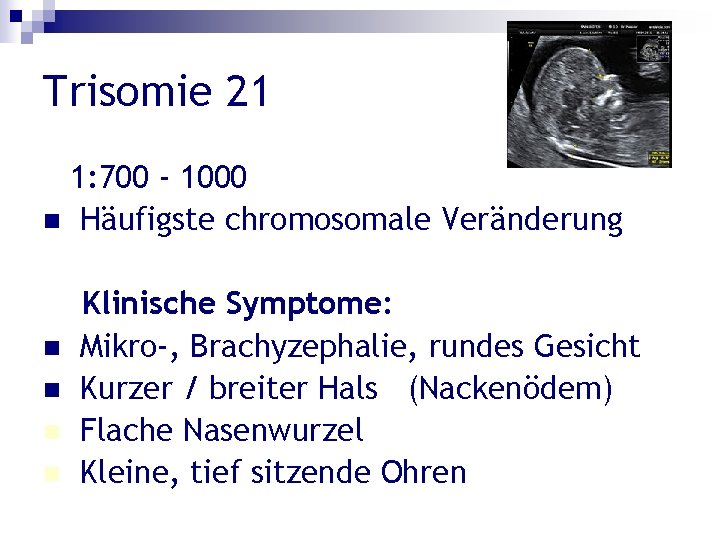 Trisomie 21 1: 700 - 1000 n Häufigste chromosomale Veränderung n n Klinische Symptome: