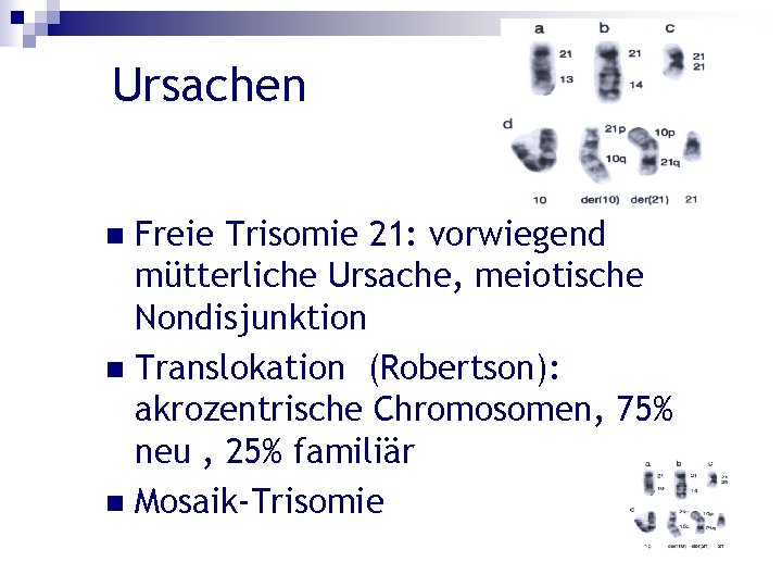 Ursachen Freie Trisomie 21: vorwiegend mütterliche Ursache, meiotische Nondisjunktion n Translokation (Robertson): akrozentrische Chromosomen,