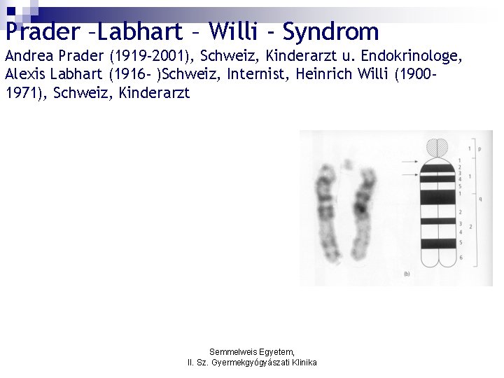 Prader –Labhart – Willi - Syndrom Andrea Prader (1919 -2001), Schweiz, Kinderarzt u. Endokrinologe,