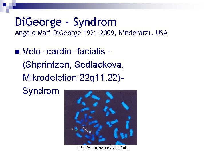 Di. George - Syndrom Angelo Mari Di. George 1921 -2009, Kinderarzt, USA n Velo-