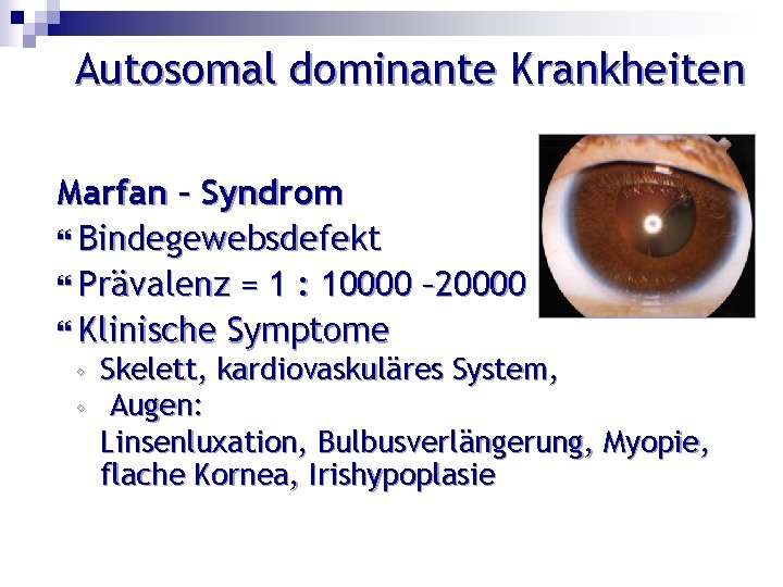 Autosomal dominante Krankheiten Marfan – Syndrom Bindegewebsdefekt Prävalenz = 1 : 10000 – 20000