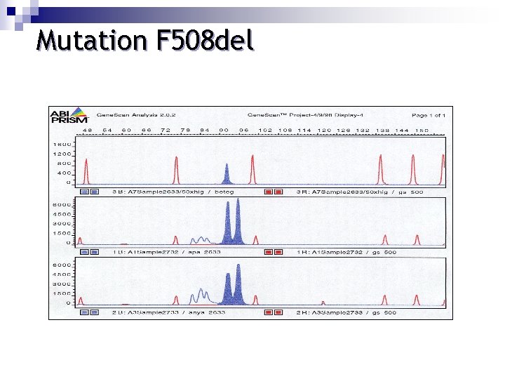 Mutation F 508 del 