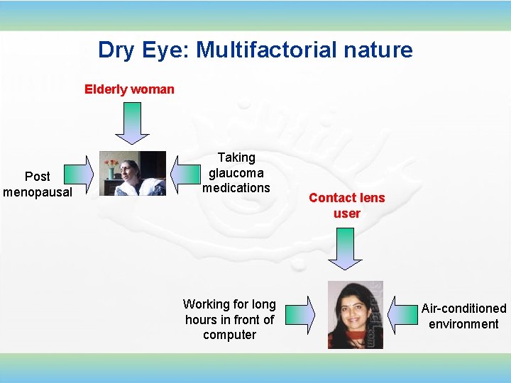 Dry Eye: Multifactorial nature Elderly woman Post menopausal Taking glaucoma medications Working for long