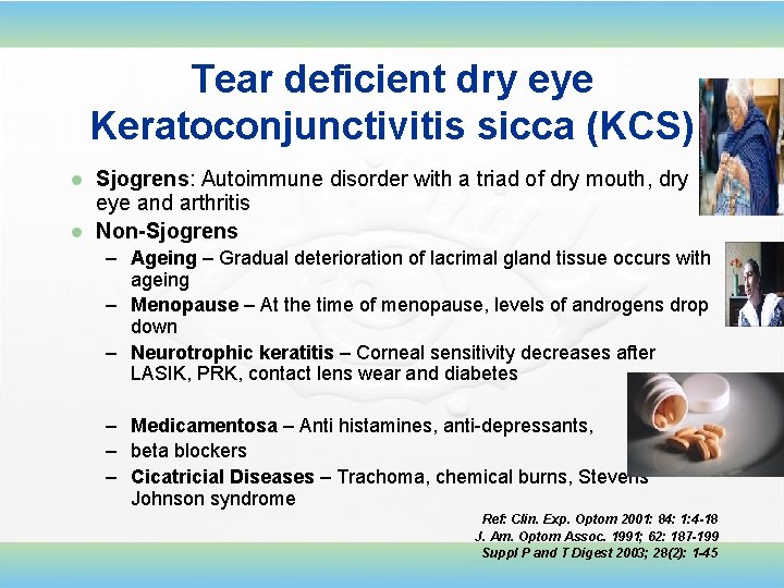 Tear deficient dry eye Keratoconjunctivitis sicca (KCS) Sjogrens: Autoimmune disorder with a triad of