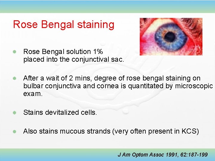 Rose Bengal staining Rose Bengal solution 1% placed into the conjunctival sac. After a