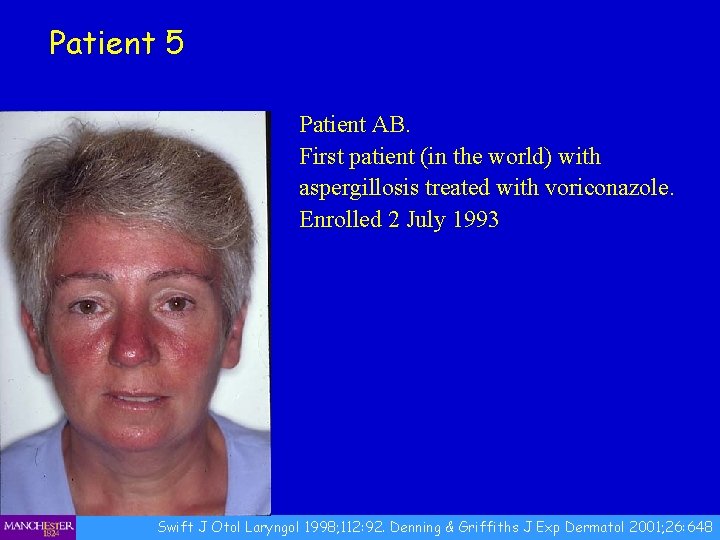 Patient 5 Patient AB. First patient (in the world) with aspergillosis treated with voriconazole.