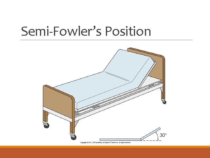 Semi-Fowler’s Position 