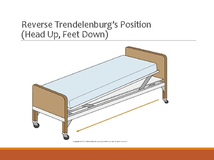 Reverse Trendelenburg’s Position (Head Up, Feet Down) 
