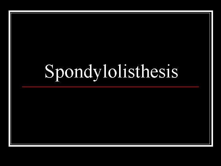 Spondylolisthesis 