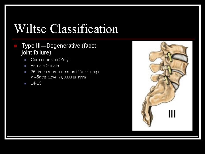 Wiltse Classification n Type III—Degenerative (facet joint failure) n n Commonest in >50 yr