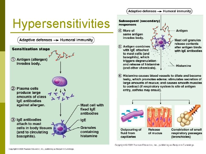 Hypersensitivities 