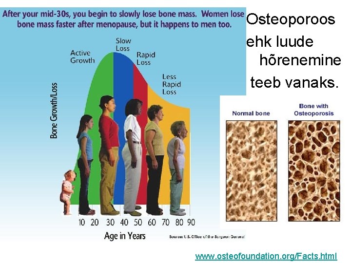 Osteoporoos ehk luude hõrenemine teeb vanaks. www. osteofoundation. org/Facts. html 