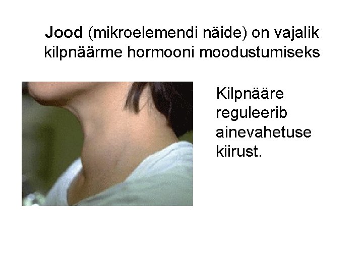 Jood (mikroelemendi näide) on vajalik kilpnäärme hormooni moodustumiseks Kilpnääre reguleerib ainevahetuse kiirust. 