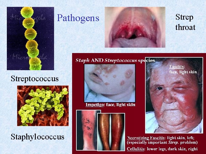 Pathogens Streptococcus Staphylococcus Strep throat 