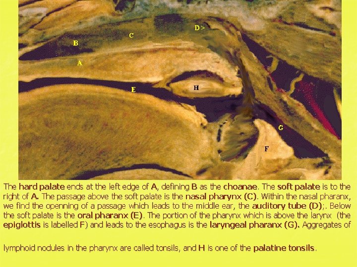 The hard palate ends at the left edge of A, defining B as the