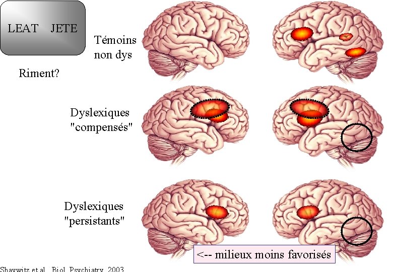 LEAT JETE Témoins non dys Riment? Dyslexiques "compensés" Dyslexiques "persistants" <-- milieux moins favorisés