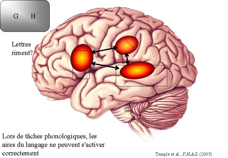 G H Lettres riment? Lors de tâches phonologiques, les aires du langage ne peuvent
