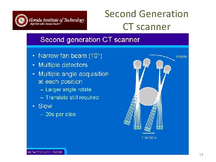 Second Generation CT scanner 13 