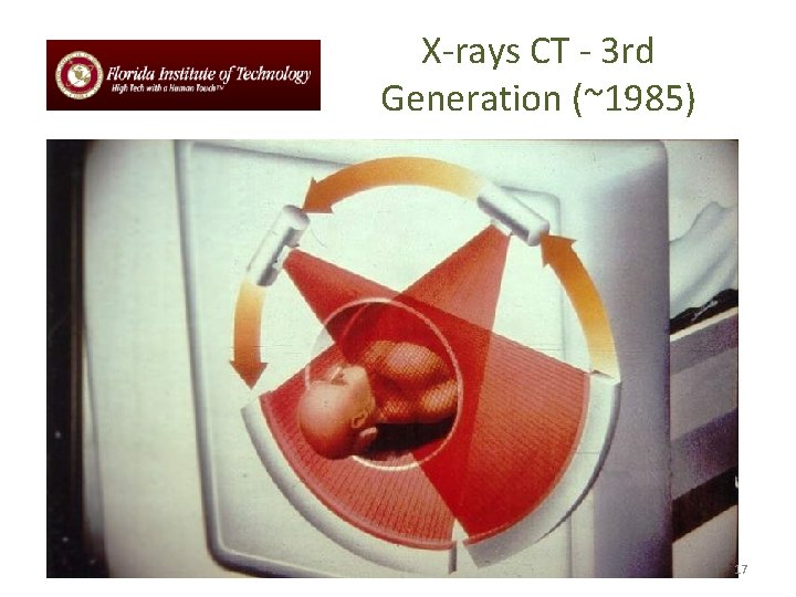 X-rays CT - 3 rd Generation (~1985) 17 