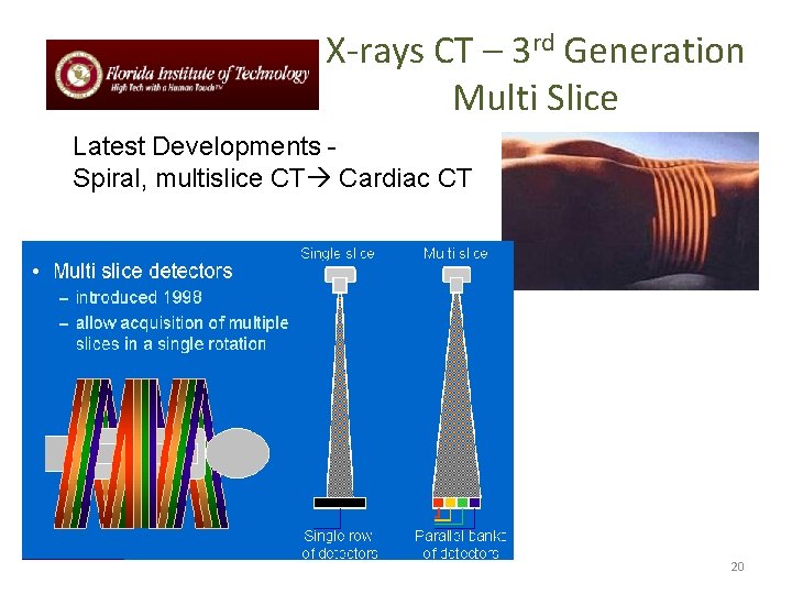 X-rays CT – 3 rd Generation Multi Slice Latest Developments Spiral, multislice CT Cardiac