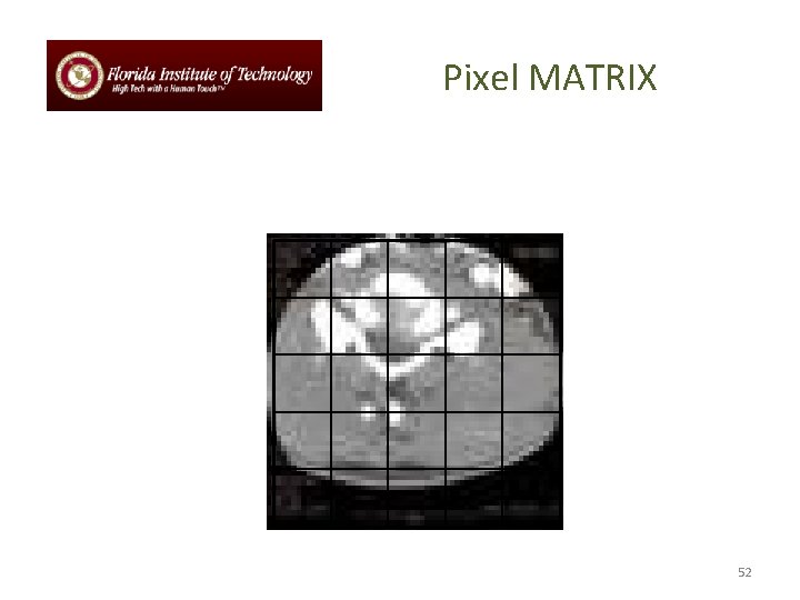 Pixel MATRIX 52 