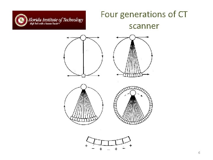 Four generations of CT scanner 6 