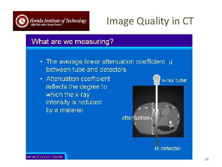 Image Quality in CT 68 